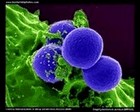MRSA micrograph